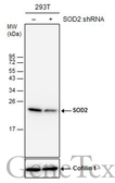 Anti-SOD2 antibody [GT17112] used in Western Blot (WB). GTX630560
