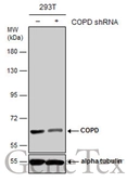 Anti-COPD antibody [GT189] used in Western Blot (WB). GTX630561