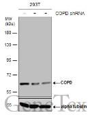 Anti-COPD antibody [GT1318] used in Western Blot (WB). GTX630562