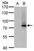 Anti-SLU7 antibody [GT262] used in Western Blot (WB). GTX630652