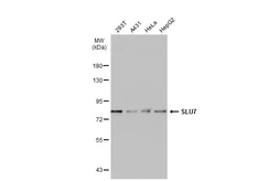 Anti-SLU7 antibody [GT759] used in Western Blot (WB). GTX630653