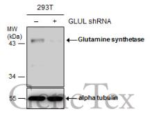 Anti-Glutamine synthetase antibody [GT1055] used in Western Blot (WB). GTX630654