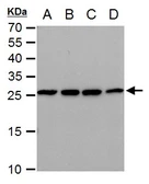 Anti-Triosephosphate isomerase antibody [GT3711] used in Western Blot (WB). GTX630780