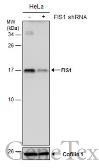 Anti-FIS1 antibody [GT4211] used in Western Blot (WB). GTX630983