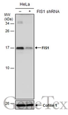 Anti-FIS1 antibody [GT4211] used in Western Blot (WB). GTX630983