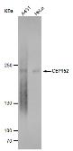 Anti-CEP152 antibody [GT1315] used in Western Blot (WB). GTX630984