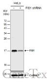 Anti-FIS1 antibody [GT12112] used in Western Blot (WB). GTX630992