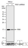 Anti-FIS1 antibody [GT12112] used in Western Blot (WB). GTX630992