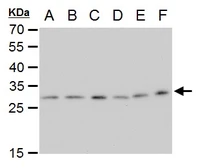 Anti-ETHE1 antibody [GT1621] used in Western Blot (WB). GTX630994
