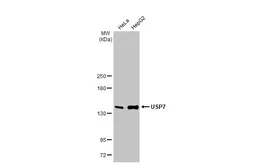Anti-USP7 antibody [GT481] used in Western Blot (WB). GTX631108
