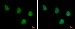 Anti-USP7 antibody [GT6512] used in Immunocytochemistry/ Immunofluorescence (ICC/IF). GTX631109