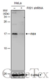 Anti-FIS1 antibody [GT9810] used in Western Blot (WB). GTX631209