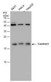 Anti-Centrin 1 antibody [GT147] used in Western Blot (WB). GTX631353