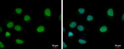 Anti-ELP3 antibody [GT11811] used in Immunocytochemistry/ Immunofluorescence (ICC/IF). GTX631395