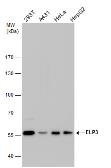 Anti-ELP3 antibody [GT11811] used in Western Blot (WB). GTX631395