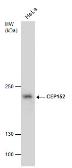 Anti-CEP152 antibody [GT1285] used in Western Blot (WB). GTX631486