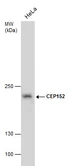 Anti-CEP152 antibody [GT1285] used in Western Blot (WB). GTX631486