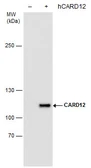 Anti-CARD12 antibody [GT1387] used in Western Blot (WB). GTX631645