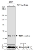 Anti-TCP1 epsilon antibody [GT639] used in Western Blot (WB). GTX631668