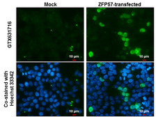 Anti-ZFP57 antibody [GT865] used in Immunocytochemistry/ Immunofluorescence (ICC/IF). GTX631716