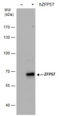 Anti-ZFP57 antibody [GT1115] used in Western Blot (WB). GTX631717