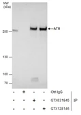 Anti-ATR (phospho Thr1989) antibody [GT222] used in Immunoprecipitation (IP). GTX631845