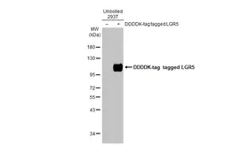 Anti-LGR5 antibody [GT11312] used in Western Blot (WB). GTX631935