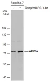 Anti-ARID5A antibody [GT18112] used in Western Blot (WB). GTX631940
