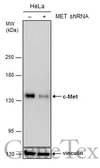 Anti-c-Met antibody [GT556] used in Western Blot (WB). GTX631992