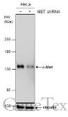 Anti-c-Met antibody [GT1586] used in Western Blot (WB). GTX631993