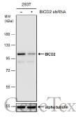 Anti-BICD2 antibody [GT10811] used in Western Blot (WB). GTX631994