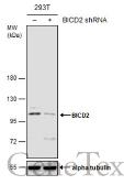 Anti-BICD2 antibody [GT1824] used in Western Blot (WB). GTX631995