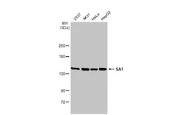 Anti-SA1 antibody [GT1515] used in Western Blot (WB). GTX632010