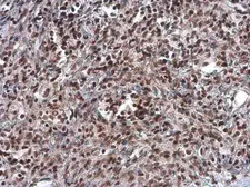 Anti-ARID1A antibody [GT3611] used in IHC (Paraffin sections) (IHC-P). GTX632013