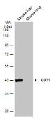 Anti-GOT1 antibody [GT638] used in Western Blot (WB). GTX632031