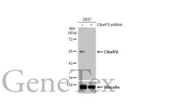 Anti-C9orf72 antibody [GT779] used in Western Blot (WB). GTX632041