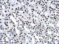 Anti-Histone H4K16ac (Acetyl Lys16) antibody [GT1271] used in IHC (Paraffin sections) (IHC-P). GTX632067