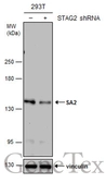 Anti-SA2 antibody [GT1417] used in Western Blot (WB). GTX632129