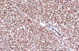 Anti-UCP1 antibody [GT3111] used in IHC (Paraffin sections) (IHC-P). GTX632185