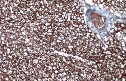 Anti-UCP1 antibody [GT1345] used in IHC (Paraffin sections) (IHC-P). GTX632186