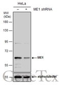 Anti-ME1 antibody [GT736] used in Western Blot (WB). GTX632188