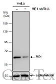 Anti-ME1 antibody [GT979] used in Western Blot (WB). GTX632189