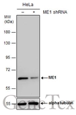 Anti-ME1 antibody [GT979] used in Western Blot (WB). GTX632189