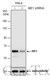 Anti-ME1 antibody [GT15611] used in Western Blot (WB). GTX632190