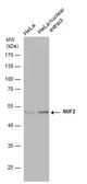 Anti-NUF2 antibody [GT312] used in Western Blot (WB). GTX632247