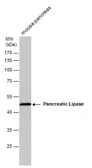 Anti-Pancreatic Lipase antibody [GT1777] used in Western Blot (WB). GTX632267