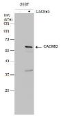Anti-CACNB3 antibody [7D1] used in Western Blot (WB). GTX632268