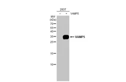 Anti-VAMP5 antibody [3E5] used in Western Blot (WB). GTX632270