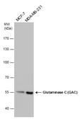 Anti-Glutaminase C (GAC) antibody [GT3211] used in Western Blot (WB). GTX632317