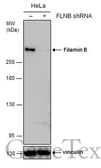 Anti-Filamin B antibody [GT1372] used in Western Blot (WB). GTX632360